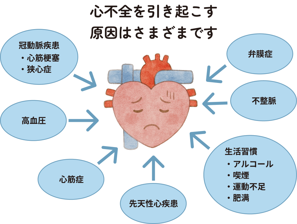 心不全を引き起こす原因について解説した画像